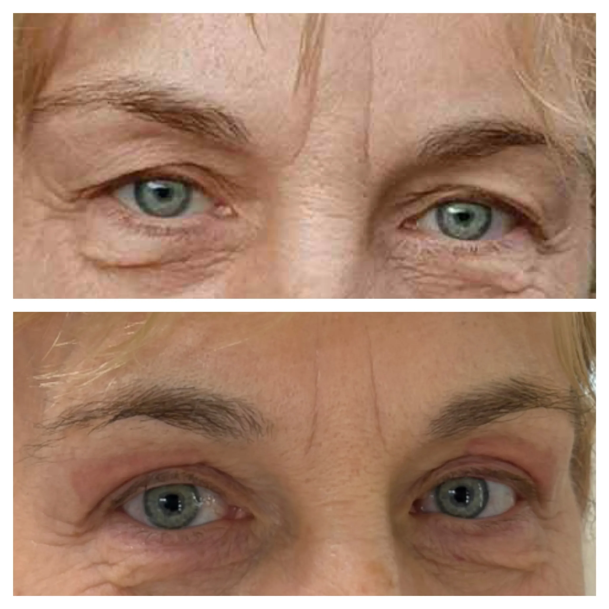 termikus ionizáció