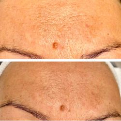 Thesera - Kónya Tündi - Kozmetika Zugló