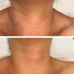 Thesera - Kónya Tündi - Kozmetika Zugló