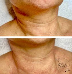 Thesera - Kónya Tündi - Kozmetika Zugló